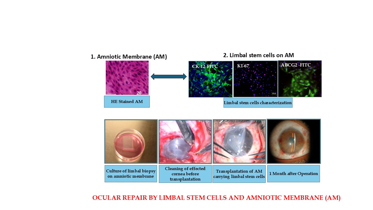 Biomedical artwork representing corneal repair with regenerative cells